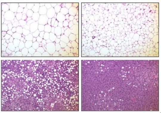 Reduced fat Mice altered to express the IKKbeta enzyme (right column) in their fat had smaller globules of fat in their subcutaneous adipose tissue (top row) and in their liver (bottom row) than normal mice (left column).	 Credit: Xu Lab/Brown University