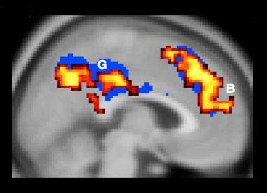 Looking at a moral choice/ Test subjects who feel that doing active harm is morally the same as allowing harm to occur will show more brain activity. The notion that active harm is worse appears to be automatic, a psychological default requiring less thought. Credit: Cushman Lab/Brown University