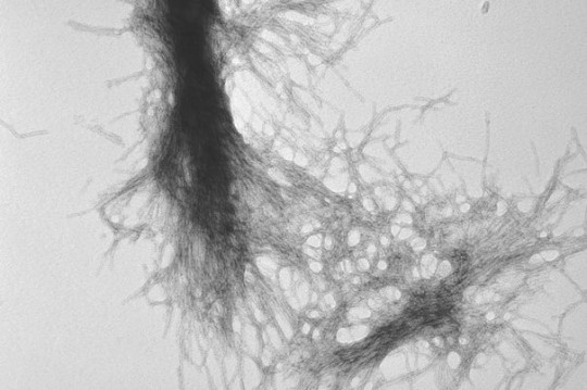 University of Tennessee "Diseases such as Huntington's, Parkinson's, and Alzheimer's disease have different causative factors, but they share common themes — such as aggregation of misfolded proteins — and a unifying end point, the degenerative loss of neurons," says Harvard Medical School Professor of Neurology Dimitri Krainc. In this image, transmission electron microscopy demonstrates the fibrillar nature of huntingtin aggregates./ Image courtesy C. Stanley, T. Perevozchikova, and V. Berthelier