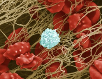 During the clotting process, blood cells become trapped in a fibrous mesh, which is formed with the help of clotting factor IX. Image by Anne Weston, Wellcome Images. All rights reserved by Wellcome Images.