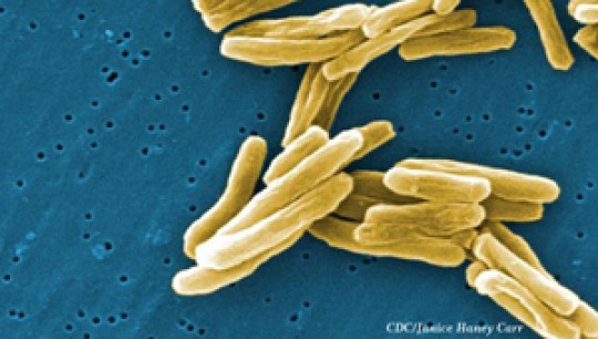 Scientists Uncover Evidence on How Drug-Resistant Tuberculosis Cells Form 