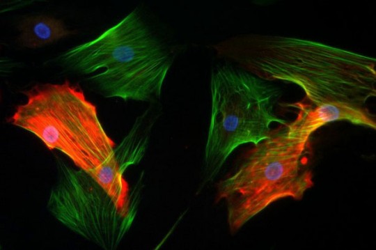 Cultured pericytes (red) and myofibroblasts (green) are two prominent noncancer cells within a tumor./Credit: Vesselina Cooke/BIDMC