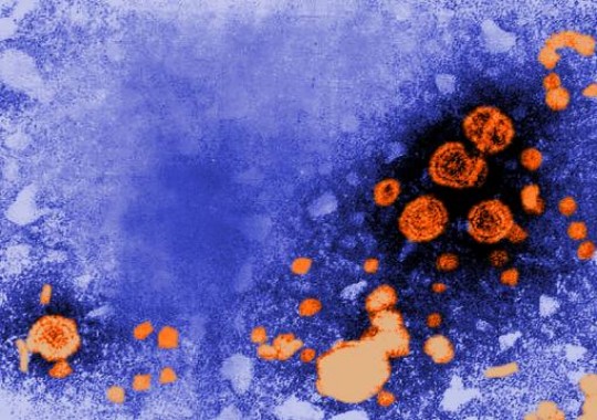 Missed opportunities/ A transmission electron microscope image shows particles of the hepatitis B virus. A vaccine has existed since 1982 but many people at high risk for getting the virus nevertheless are not innoculated./ Credit: CDC/ Dr. Erskine Palmer