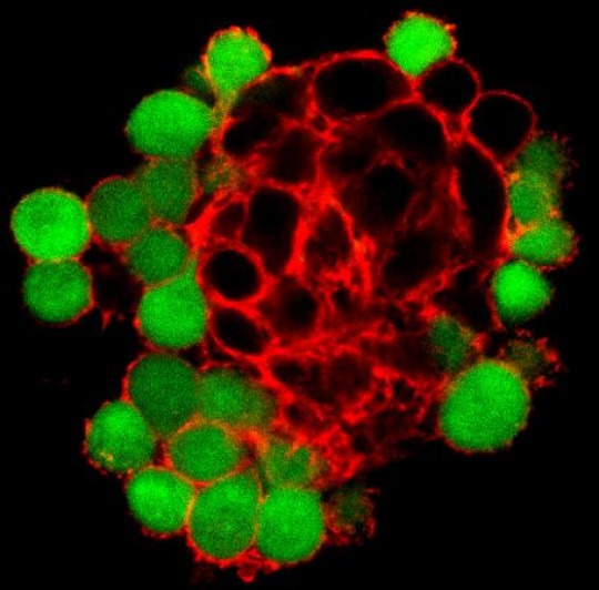 Ties that bind/ Cancerous rat cells (black) expressing the protein Pannexin1 are bound within a strong network of actin (red), while adjacent cells that don't express Pannexin1 (green) have much less developed actin network around them. (Click image for higher resolution.)	/ Credit: Brian Bao/Brown University.