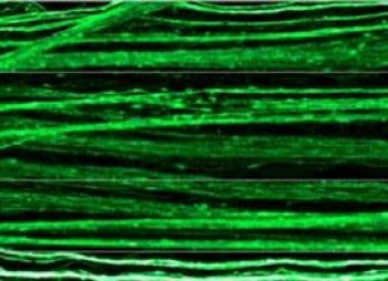 Nerve fibers created from DRG neurons