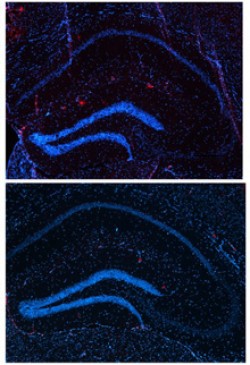 After 2 weeks, the brains of mice treated with bexarotene (bottom) have fewer amyloid plaques (red) than untreated mice (top). Image by Cramer et al., courtesy of Science.