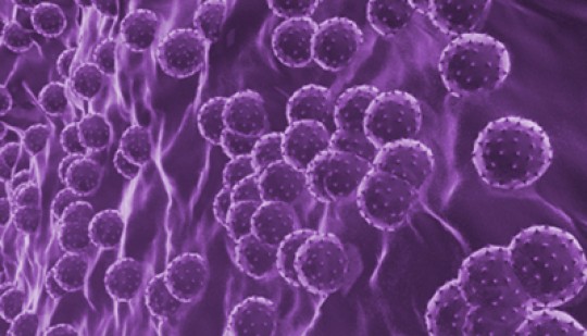 Hepatitis C virus. Image by the U.S. Department of Veterans Affairs.