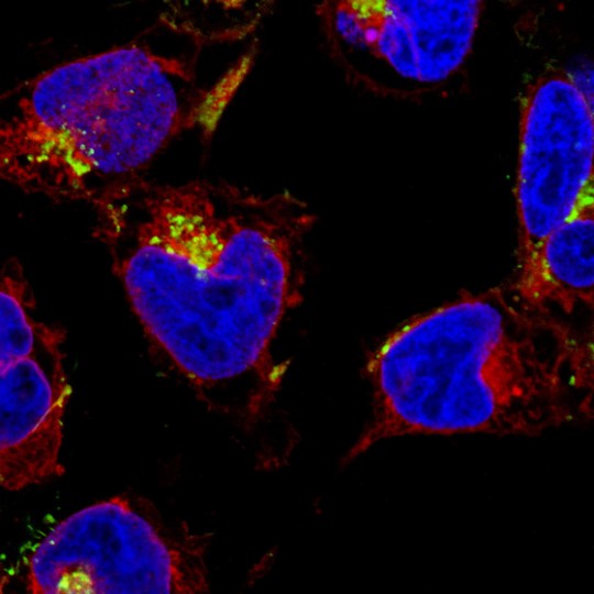 Happy Valentine’s Day: Picture of heart-shaped heart muscle nuclei