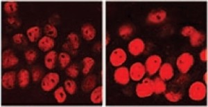 HDAC2 levels (red) are higher in cells from the hippocampus of a mouse model of Alzheimer's disease (right) than in cells from a normal mouse hippocampus (left) Image by Johannes Gräff et al, courtesy of Nature.