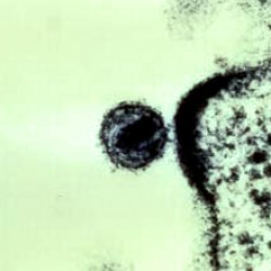 HIV "budding" out of a T-cell. Image courtesy of Dr. Tom Folks, NIAID.