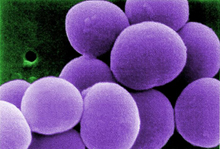 Staphylococcus, one of the types of bacteria identified in the study. Image by Matthew J. Arduino, CDC.