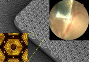 A pinpoint-sized photovoltaic chip implanted under the retina of a blind rat (upper right). The background image shows the chip’s array of photodiodes. A single pixel of the implant (lower left) shows 3 diodes around the perimeter and an electrode in the center. The diodes turn light into an electric current that flows from the chip into the inner layer of retinal cells. Image courtesy of the Palanker lab.