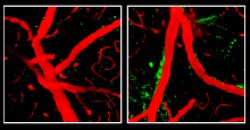 Destructive enzymes (green) become more active and weaken the blood-brain barrier in mice that are genetically engineered to produce only human APOE4 (right), rather than mouse APOE (left). Image courtesy of Dr. Robert Bell, University of Rochester Medical Center.