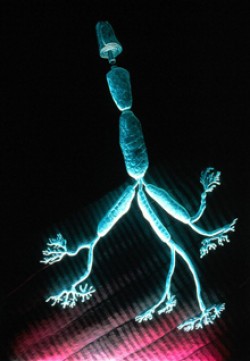 The long axon of a motor neuron relays signals from nerve to muscle cells. Mutations in the PFN1 gene may inhibit axon growth. Image by John Wildgoose, Wellcome Images. All rights reserved by Wellcome Images.