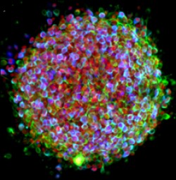 A cluster of human stem cells expressing neural proteins. Courtesy of Dr. Ole Isacson, McLean Hospital and Harvard Medical School.