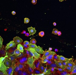 Cultured colon cancer cells. Image by Lorna McInroy, Wellcome Images. All rights reserved by Wellcome Images.