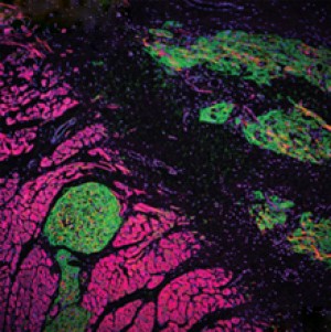 Scientists showed that transplanted human heart cells (green) could beat in sync with neighboring guinea pig cells (pink) and prevent abnormal rhythms. Image by Shiba et al., courtesy of Nature.