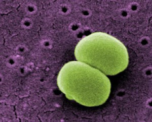 Staphylococcus epidermidis. Image by Janice Carr, courtesy of CDC/ Segrid McAllister.