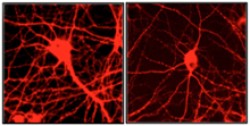 Raising expression of the Gata1 gene decreases the number of neuron connections (right) compared to controls (left). Image courtesy of Duman laboratory.