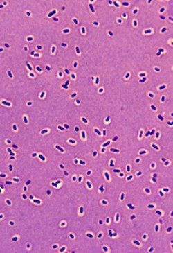 Klebsiella pneumoniae. Image by Spike Walker, Wellcome Images. All rights reserved by Wellcome Images.