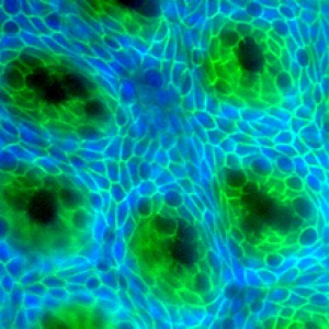 Crypts (dark green) are stem-cell-containing glands that help to regenerate the intestinal lining. Image by Hiroyuki Miyoshi, University of Washington in St. Louis.