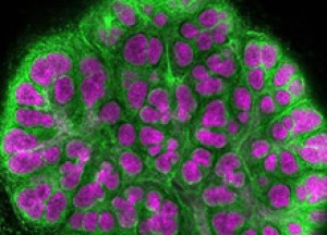 A mouse embryonic salivary gland. Credit: Melinda Larsen et al., Developmental Biology 255: 178-191, 2003.