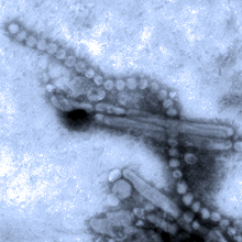 Transmission electron micrograph of the new influenza A (H7N9) virus. Courtesy of Cynthia S. Goldsmith and Thomas Rowe, Centers for Disease Control and Prevention.