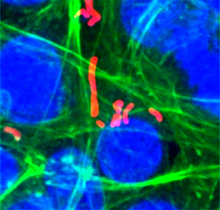 Listeria (red) inside pancreatic tumor cells 6 hours after infection. Image by the Gravekamp and Dadachova labs, used courtesy of PNAS.