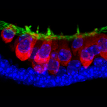 Stem-cell-derived sensory hair cells (in red) with hair bundles (green). Cell nuclei appear blue. Courtesy of Indiana University.