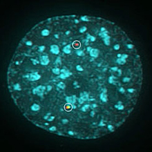 A chromosome translocation is visualized by breaks marked with differently colored fluorescent proteins (green, red). DNA is stained blue. Courtesy of NCI.