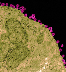 AIDS virus particles (pink) budding from the surface of an immune cell. Image by R. Dourmashkin, Wellcome Images. All rights reserved by Wellcome Images.