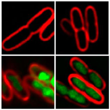 By comparing the appearance of bacterial cells treated with different antibiotic compounds, researchers can determine their likely mode of action. Image by the researchers, courtesy of PNAS.