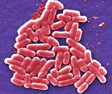 Escherichia coli. Image by Janice Haney Carr, courtesy of CDC.