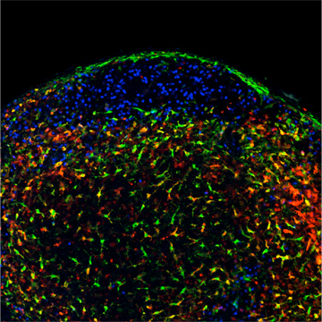 A micrograph section through a lymph node shows different cell types involved in immune response: The green cells in the periphery are macrophages, B cells are blue; dendritic cells are yellow/orange, and the small red cells reflect a subset of memory T cells. Image: von Andrian Lab