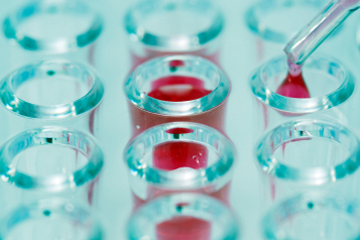 Unnecessary Testing? Study finds inappropriate laboratory testing throughout medicine