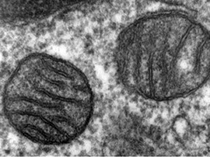 Finding what may be the final protein that allows mitochondria to absorb vital calcium promises to not only further explain how these cellular powerhouses work but also open the door for investigating links to rare and common diseases. Image: Wikimedia Commons