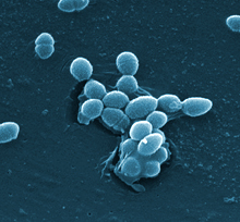 The bacterium Enterococcus faecalis, which lives in the human gut. Credit: Centers for Disease Control and Prevention (CDC).
