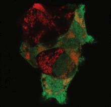 Turning off some genes, like HSPAI1L, inhibits parkin (green) from tagging damaged mitochondria (red). Image by the Youle lab, courtesy of Nature.
