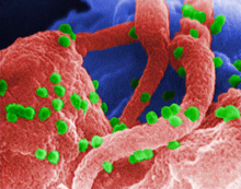 Electron micrograph of HIV (colored green) on human lymphocytes. Image by C. Goldsmith, P. Feorino, E. L. Palmer, and W. R. McManus, courtesy of CDC.