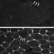 Human protein improves muscle function of muscular dystrophy mice