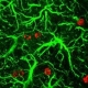 Anti-Depressants Boost Brain Cells after Injury in Early Studies