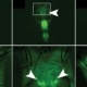 Altered gene tracks RNA editing in neurons.