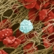 Gene Therapy Helps Patients with Hemophilia
