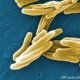 Scientists Uncover Evidence on How Drug-Resistant Tuberculosis Cells Form