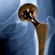 Body Produces “Industrial” Lubricant for Metal Hip Implants