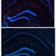 Drug Improves Alzheimer's-like Condition in Mice