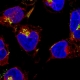 Happy Valentine’s Day: Picture of heart-shaped heart muscle nuclei.