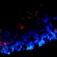 Stem Cell Study in Mice Offers Hope for Treating Heart Attack Patients