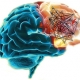Mutated Genes in Schizophrenia Map to Brain Networks