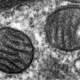 Mitochondrial Mystery. 